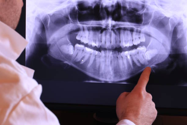 Best Weekend Emergency Dentist in Hallsville, TX