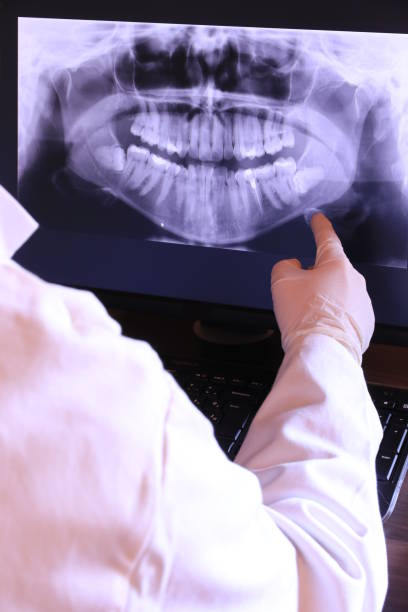 Best Emergency Tooth Extraction in Hallsville, TX