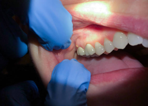 Best Pediatric Emergency Dentist in Hallsville, TX