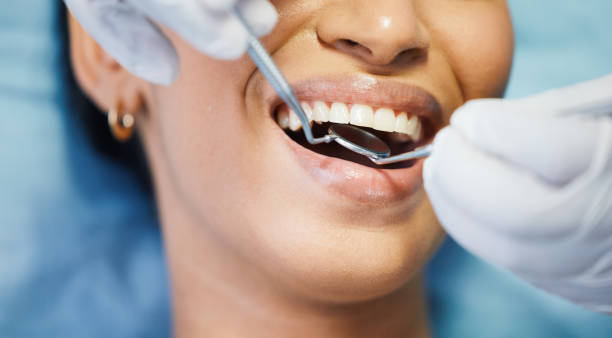 Best Emergency Tooth Extraction in Hallsville, TX