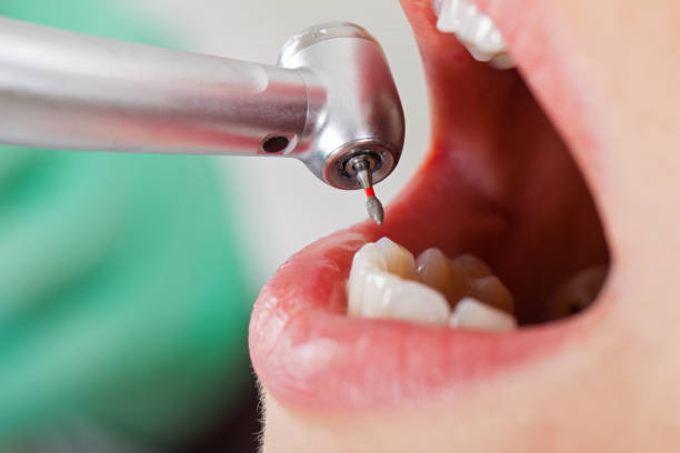 Best Weekend Emergency Dentist in Hallsville, TX